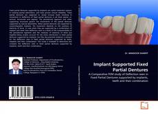 Buchcover von Implant Supported Fixed Partial Dentures