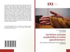 Couverture de Les lésions cutanées accidentelles en milieu agroalimentaire