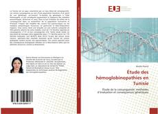 Copertina di Étude des hémoglobinopathies en Tunisie