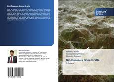 Bookcover of Bio-Osseous Bone Grafts