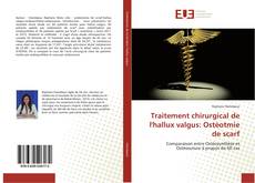 Bookcover of Traitement chirurgical de l'hallux valgus: Ostéotmie de scarf