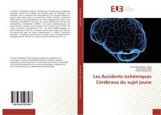 Les Accidents Ischémiques Cérébraux du sujet jeune kitap kapağı