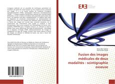 Capa do livro de Fusion des images médicales de deux modalités : scintigraphie osseuse 