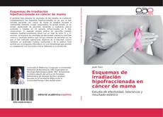 Esquemas de irradiación hipofraccionada en cáncer de mama kitap kapağı