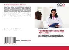 Обложка Manifestaciones cutáneas del cáncer