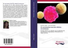 Buchcover von El carcinoma oral de células escamosas