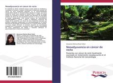 Bookcover of Neoadyuvancia en cáncer de recto