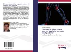 Bookcover of Efecto en el apoyo tras la punción seca en el músculo tibial posterior