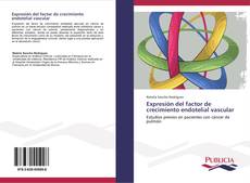 Bookcover of Expresión del factor de crecimiento endotelial vascular
