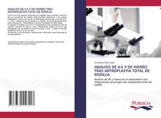 Buchcover von ANALISIS DE IL6 Y DE HIERRO TRAS ARTROPLASTIA TOTAL DE RODILLA