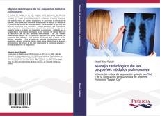 Bookcover of Manejo radiológico de los pequeños nódulos pulmonares