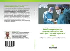 Borítókép a  Комбинированное лечение метастазов колоректального рака в печень - hoz