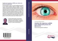 Обложка Análisis de registros mfERG para detección precoz de glaucoma