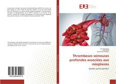 Buchcover von Thromboses veineuses profondes associées aux néoplasies