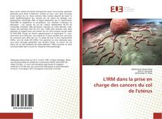 Обложка L'IRM dans la prise en charge des cancers du col de l'utérus