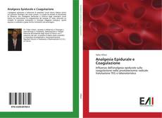Analgesia Epidurale e Coagulazione kitap kapağı