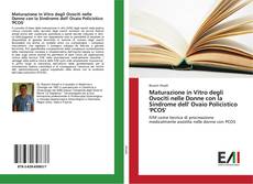Bookcover of Maturazione in Vitro degli Ovociti nelle Donne con la Sindrome dell' Ovaio Policistico 'PCOS'