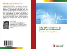Buchcover von FDG-18F na distinção de placas ateroscleróticas