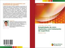 Capa do livro de Estabilidade de mini-implantes com tratamento de superfície 