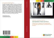 Bookcover of Artroplastia Total da Anca