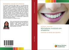 Couverture de Alinhadores invisíveis em ortodontia