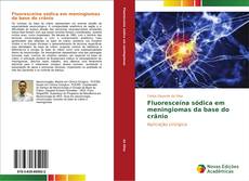 Capa do livro de Fluoresceína sódica em meningiomas da base do crânio 