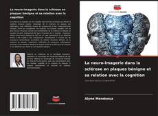 Borítókép a  La neuro-imagerie dans la sclérose en plaques bénigne et sa relation avec la cognition - hoz