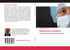 Bookcover of Metástasis encefálica