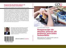 Capa do livro de Preparación de dientes pilares de prótesis parciales removibles 