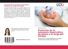 Bookcover of Evolución de la estenosis hipertrófica de píloro a lo largo del tiempo