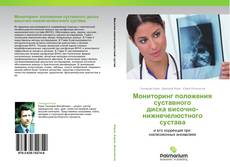 Buchcover von Мониторинг положения суставного диска височно-нижнечелюстного сустава