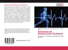 Bookcover of Sindrome de Destrucción Vertebral