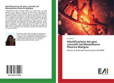 Capa do livro de Identificazione dei geni coinvolti nel Mesotelioma Pleurico Maligno 