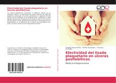 Bookcover of Efectividad del lisado plaquetario en úlceras posflebíticas