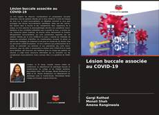 Borítókép a  Lésion buccale associée au COVID-19 - hoz