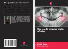 Borítókép a  Manejo do terceiro molar inferior - hoz