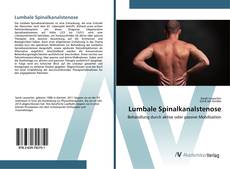 Bookcover of Lumbale Spinalkanalstenose