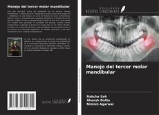 Buchcover von Manejo del tercer molar mandibular
