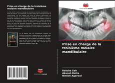 Buchcover von Prise en charge de la troisième molaire mandibulaire