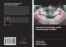 Portada del libro de Leczenie trzeciego zęba trzonowego żuchwy