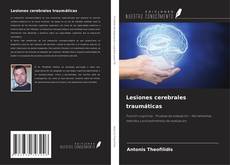 Buchcover von Lesiones cerebrales traumáticas