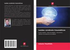 Couverture de Lesões cerebrais traumáticas
