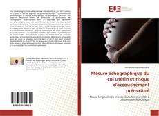 Copertina di Mesure échographique du col utérin et risque d'accouchement prématuré