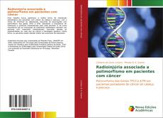 Buchcover von Radioinjúria associada a polimorfismo em pacientes com câncer