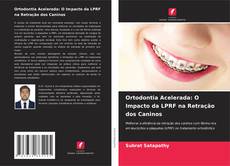 Borítókép a  Ortodontia Acelerada: O Impacto da LPRF na Retração dos Caninos - hoz