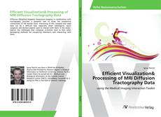 Copertina di Efficient Visualization& Processing of MRI Diffusion Tractography Data