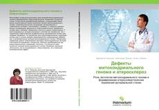 Bookcover of Дефекты митохондриального генома и атеросклероз