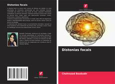 Distonias focais的封面