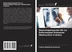 Copertina di Descompensación De La Enfermedad Pulmonar Obstructiva Crónica