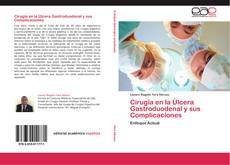Bookcover of Cirugía en la Úlcera Gastroduodenal y sus Complicaciones